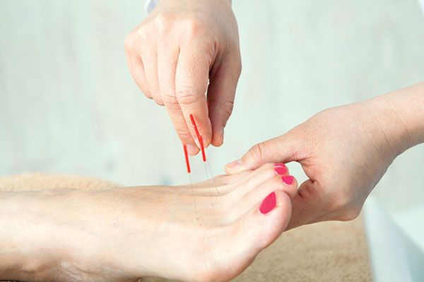 Foot getting acupuncture